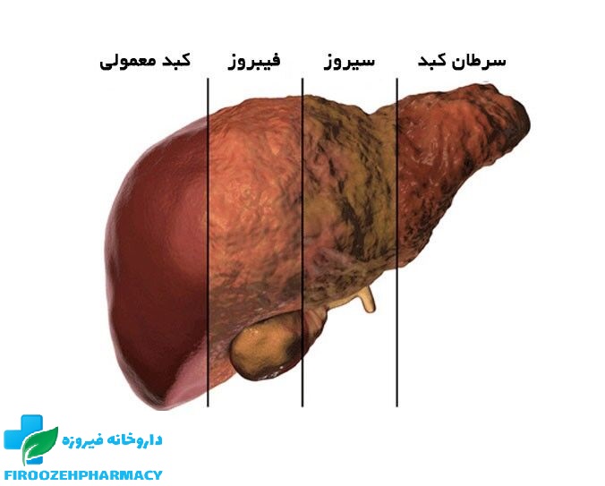 کبد چرب،دشمن خاموش